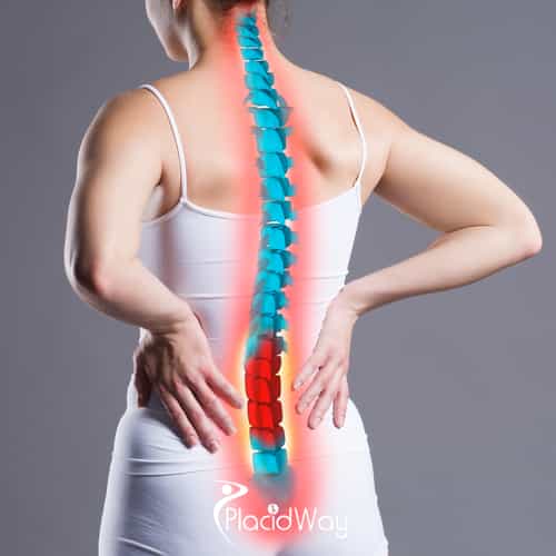 A Guide to Germany Spine Surgery for CIS Patients: Visa, Clinics and Travel Cost